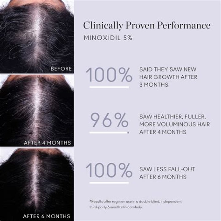 Can I use minoxidil once per day?