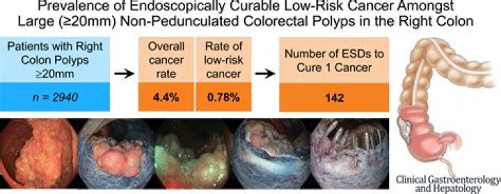 Is a 1 cm polyp big?