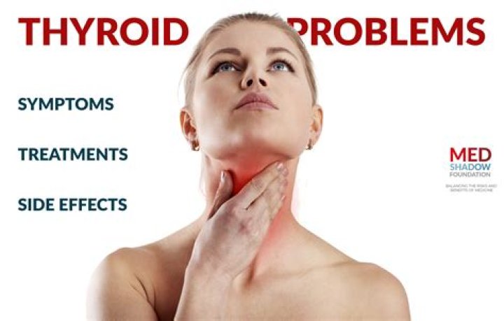 Is urticaria related to thyroid?