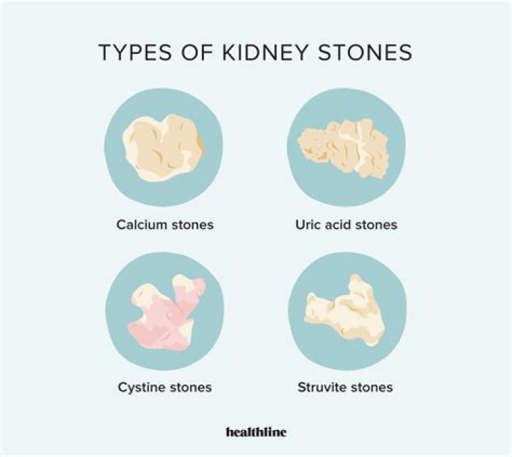 What are litho stones made of?
