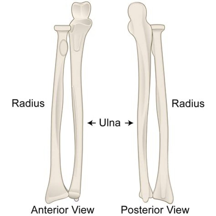 What does a four block radius mean?