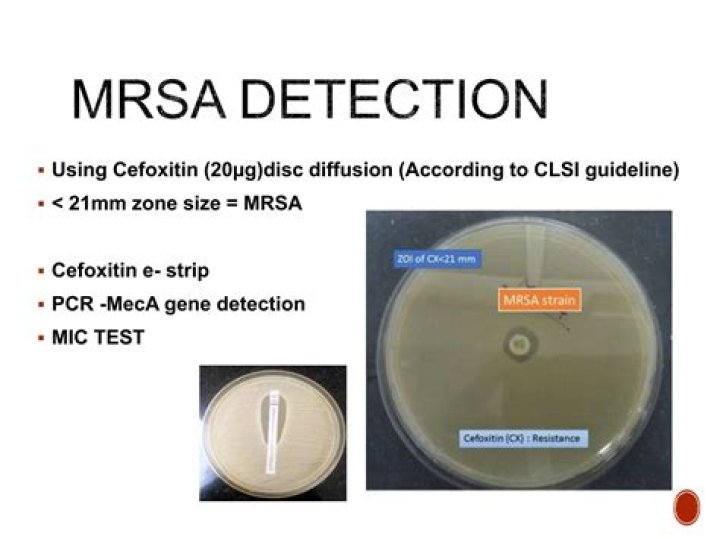 What is a cefoxitin screen test?