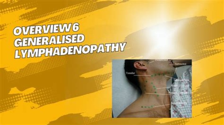 What is generalized lymphadenopathy indicative of?