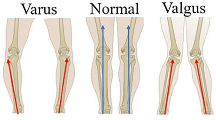 What is valgus and varus force?