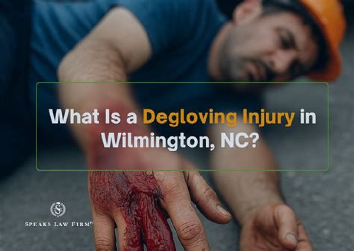 What was Rgiii injury?